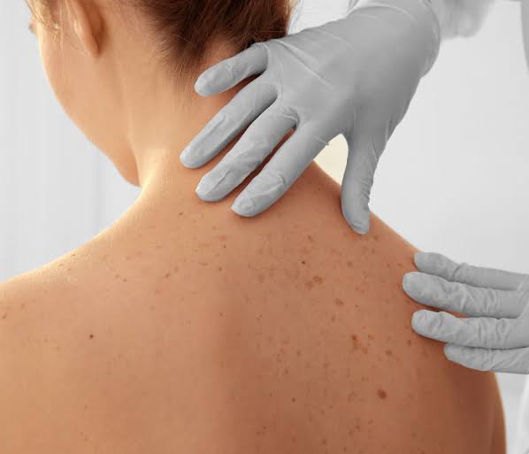 Dermatologist consultation for skin disorders and infections